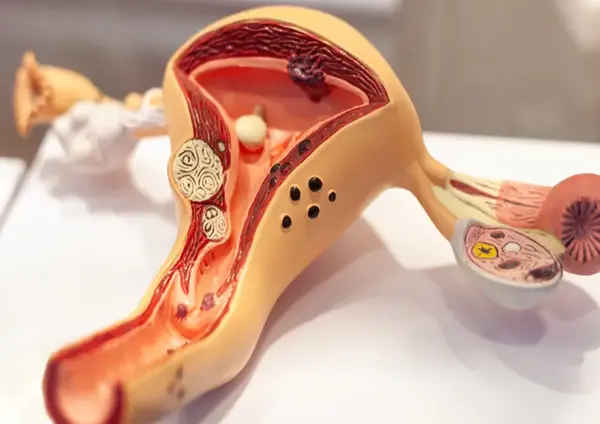 عکس رنگی رحم