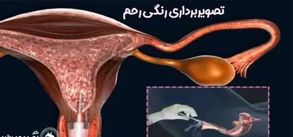 عکس رنگی رحم