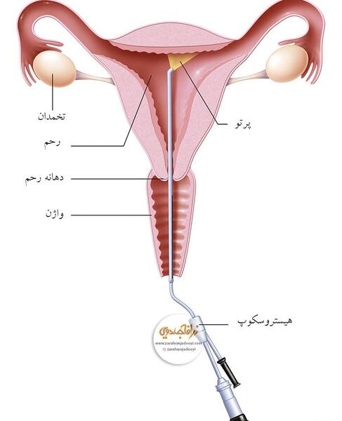 عکس رنگی رحم