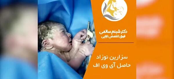 عکس بچه های ای وی افی