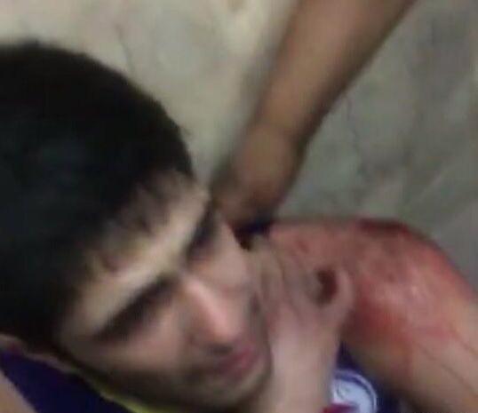 عکس چاقو خوردگی شکم