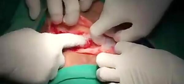عکس چاقو خوردگی شکم