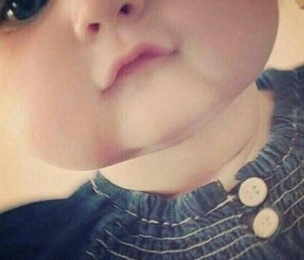 عکس بچه ویسگون