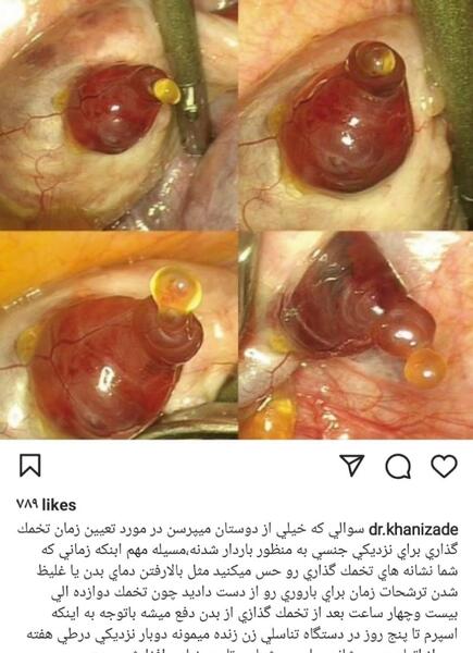 عکس آزاد شدن تخمک