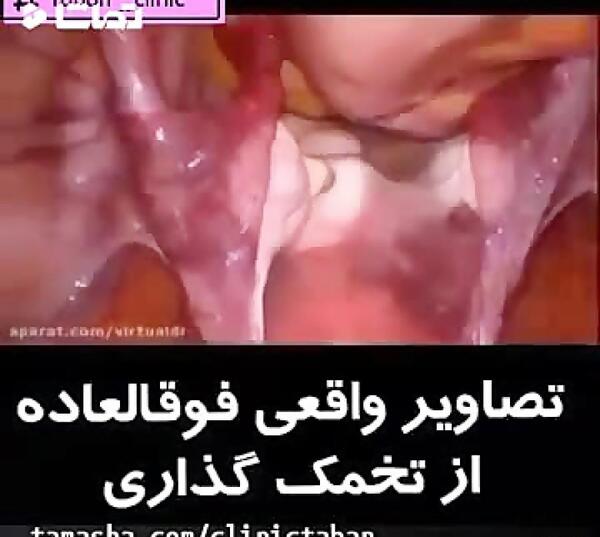 عکس آزاد شدن تخمک