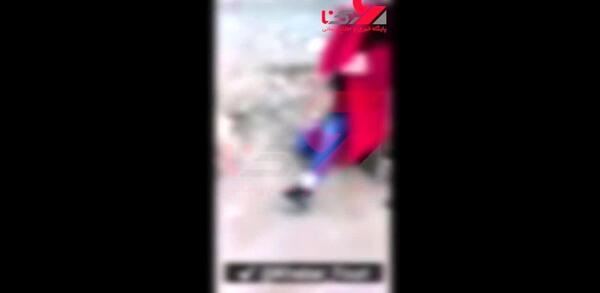 چشم عکس صورت دختری که در سیرجان کتک خورد