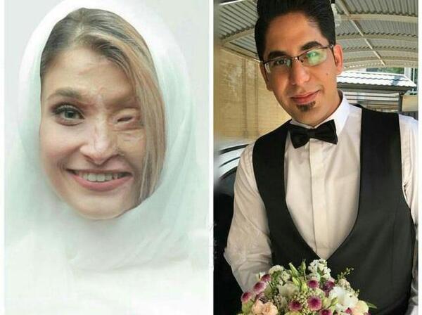 عکس بچه صورت