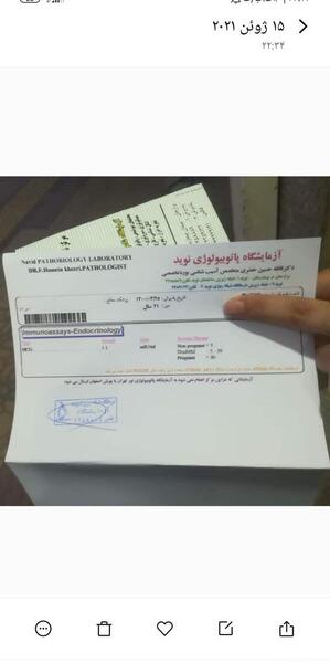 عکس جواب آزمایش بارداری مثبت