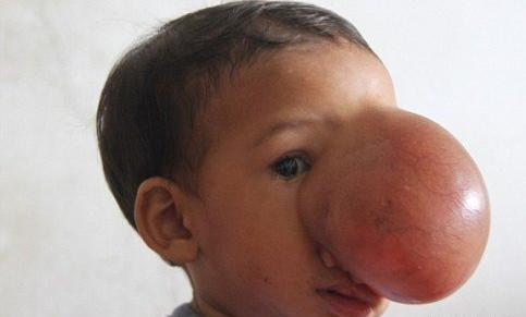 عکس صورت دختر