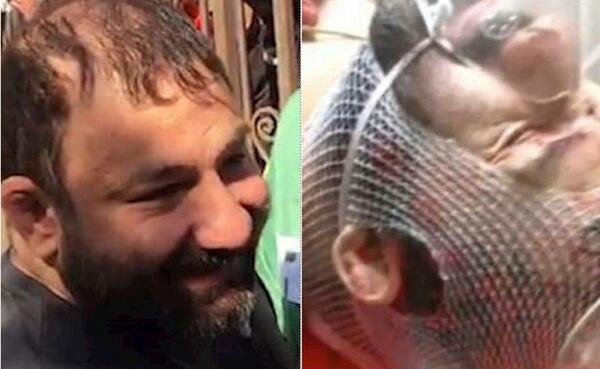 عکس چاقو خوردن صورت