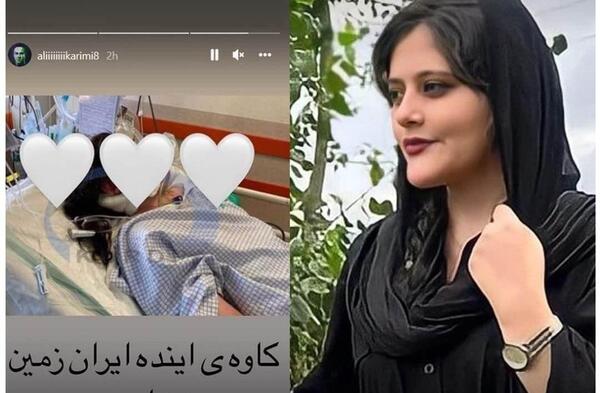 عکس جمجمه ی مهسا امینی