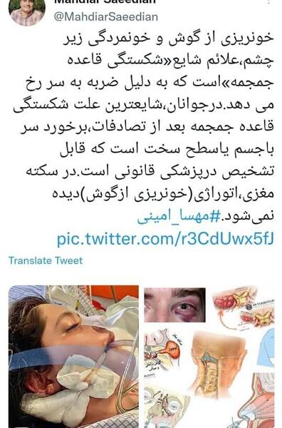 عکس مهسا امینی خونریزی گوش
