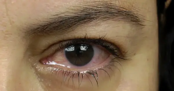عکس چشم سبز غمگین