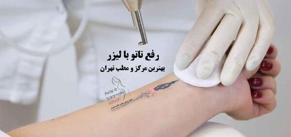 عکس تاتو روی زخم دست