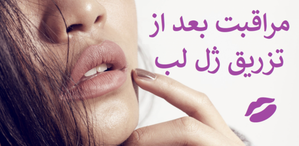 عکس روز اول ژل لب