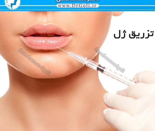 عکس روز اول ژل لب