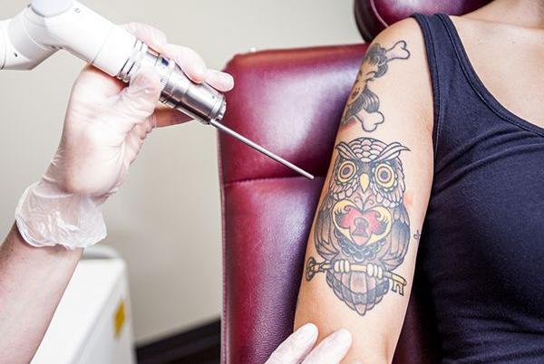 عکس چگونه تاتو روی دست را پاک کنیم