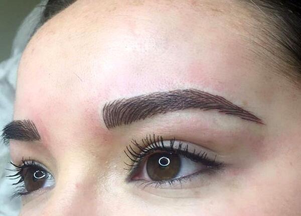 عکس چگونه تاتو روی دست را پاک کنیم