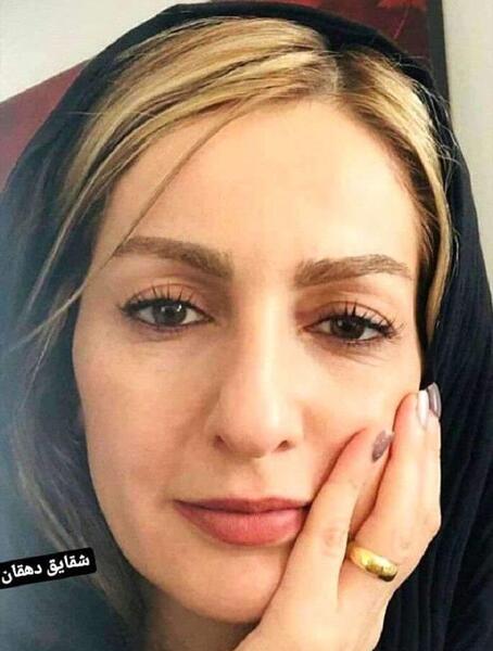عکس تتوی دست شقایق دهقان