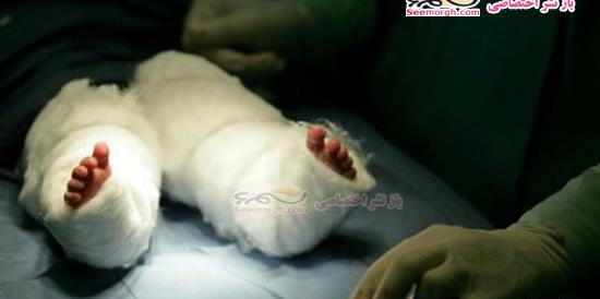 عکس عروس دریایی واقعی در ایران