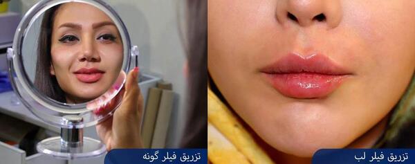 عکس فیلم خنده دار ژل میزنی موهام فره