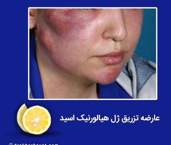 عکس فیلم خنده دار ژل میزنی موهام فره