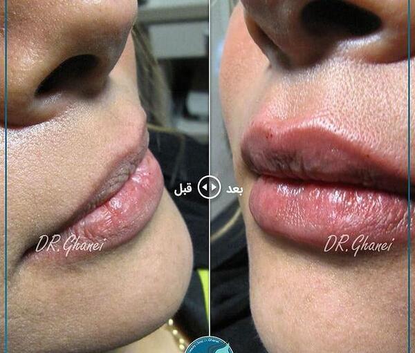 عکس فیلم خنده دار ژل میزنی موهام فره