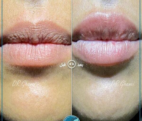 عکس فیلم خنده دار ژل میزنی موهام فره