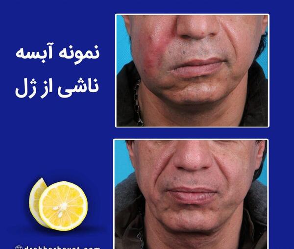 عکس فیلم خنده دار ژل میزنی موهام فره