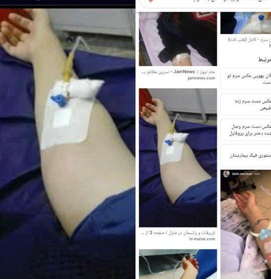 عکس سرم دست دختر نی نی سایت