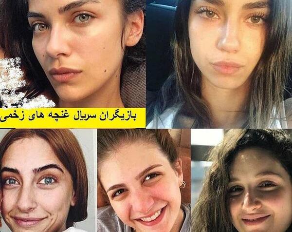 عکس خنده دار غنچه های زخمی