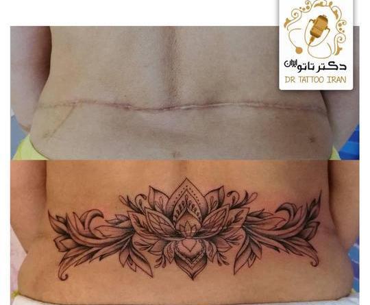 عکس طرح تاتو گل رو شکم