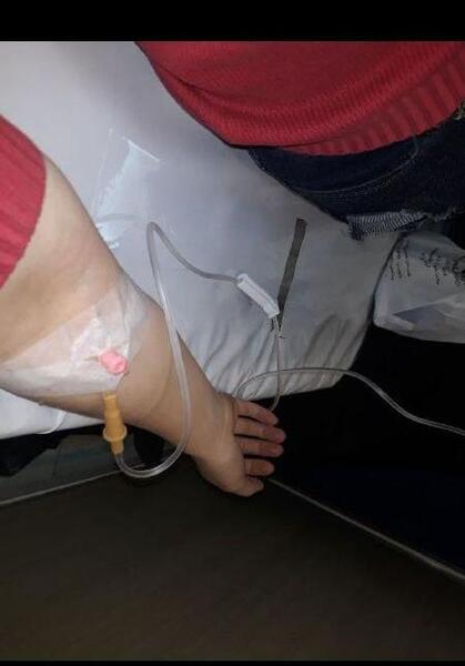 عکس سرم دست دختر تپل