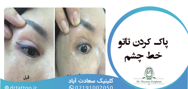 عکس تاتو خط چشم بدون درد