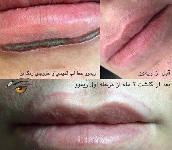 عکس تاتو خط لب