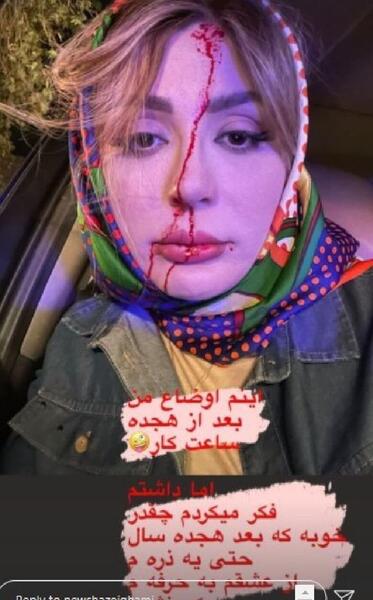 عکس نیوشا ضیغمی بدون ارایش