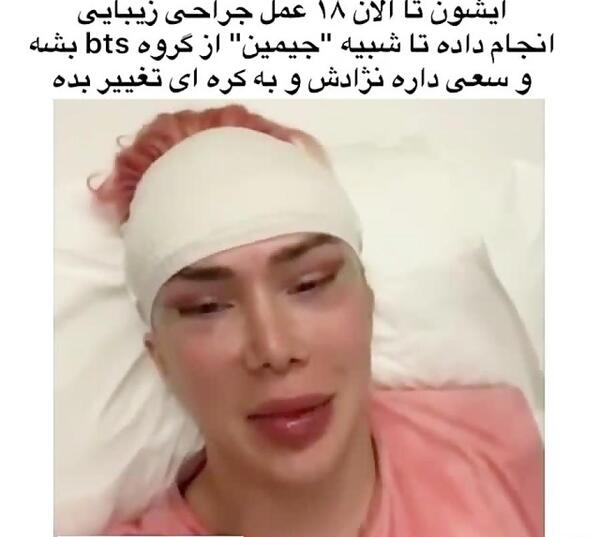عکس جیمین قبل از عمل زیبایی