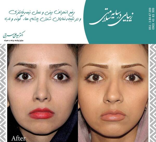 عکس ترنس های شیراز