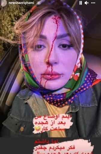 عکس تصاویر نیوشا ضیغمی بدون آرایش