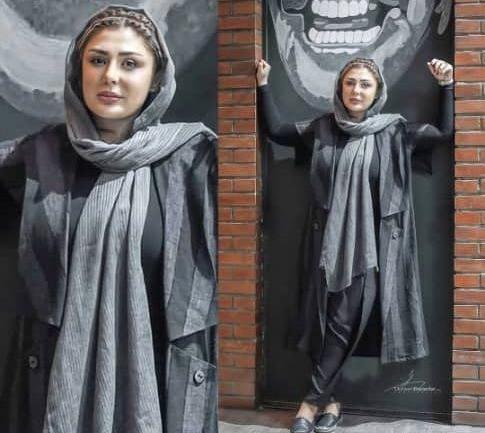 عکس نیوشا ضیغمی قبل از عمل جراحی بینی