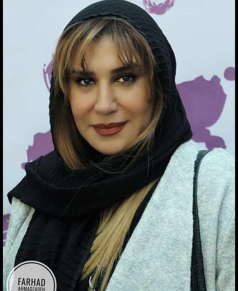 عکس نیوشا ضیغمی قبل از عمل جراحی بینی