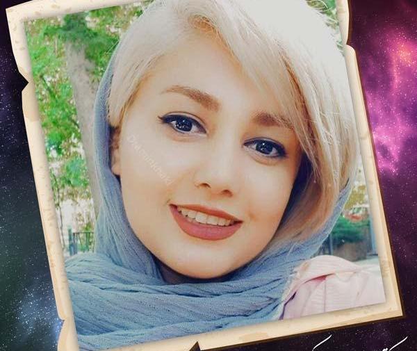 عکس نیوشا ضیغمی قبل از عمل جراحی بینی