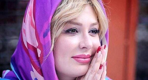 عکس نیوشا ضیغمی قبل از عمل جراحی بینی