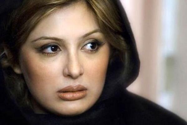 عکس نیوشا ضیغمی قبل از عمل جراحی بینی