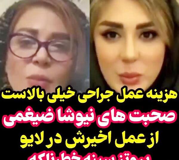 عکس نیوشا ضیغمی قبل از عمل جراحی بینی