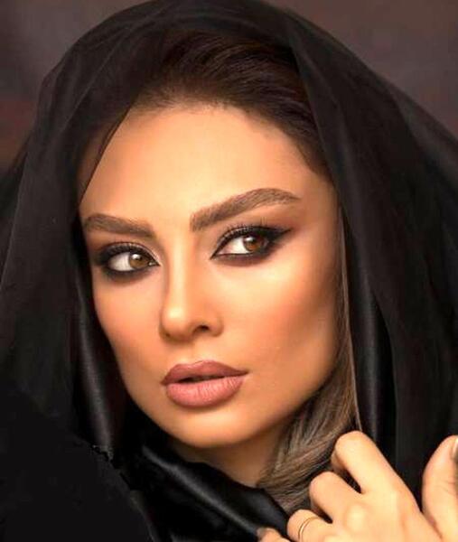 عکس الناز گلرخ قبل از عمل زیبایی
