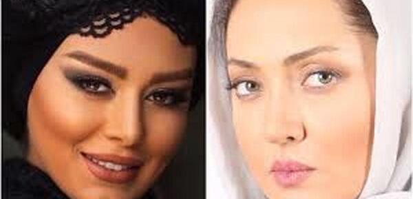 عکس الناز گلرخ قبل از عمل زیبایی