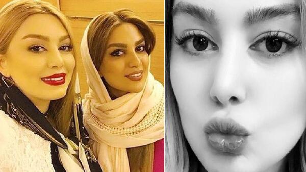 عکس الناز گلرخ قبل از عمل زیبایی