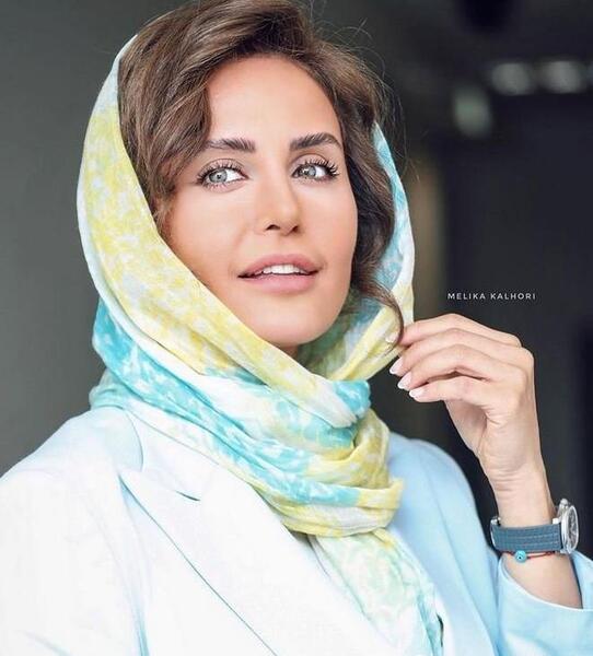 عکس الناز گلرخ قبل از عمل زیبایی