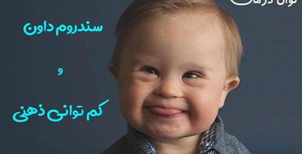عکس دختر ذهن